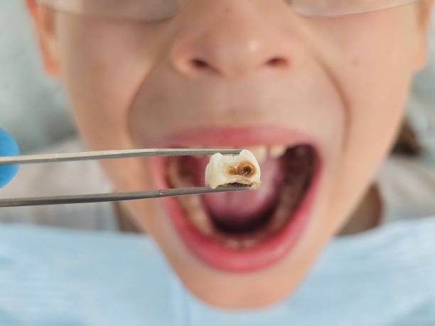 Best Emergency Dental Care for Trauma or Injury in Hanover Park, IL